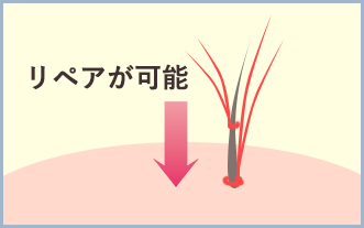 増毛イメージ